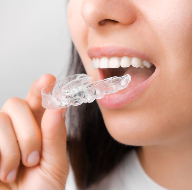 Ortodoncia en Las Rozas