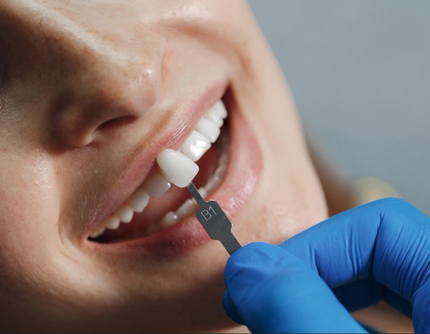 mejores implantes dentales en las Rozas